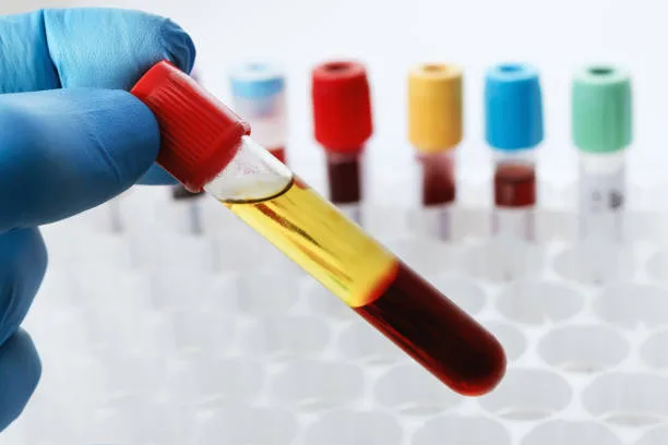Plasma sanguíneo